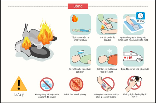 Phải làm sao khi bị bỏng?