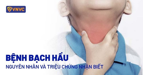 Bệnh Bạch hầu và những điều cần biết