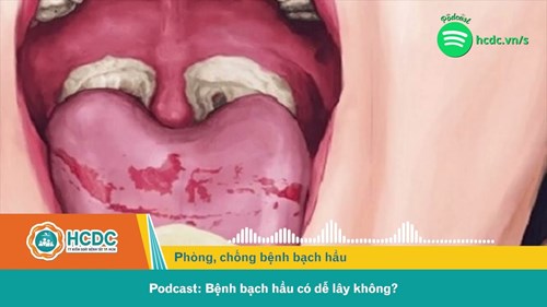 Bệnh bạch hầu có dễ lây không?