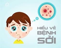 Thông báo: Chiến dịch Tiêm,ngừa Sởi- Rubella (MR) cho trẻ