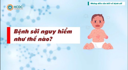 Phát thanh truyền thông về bệnh Sởi.