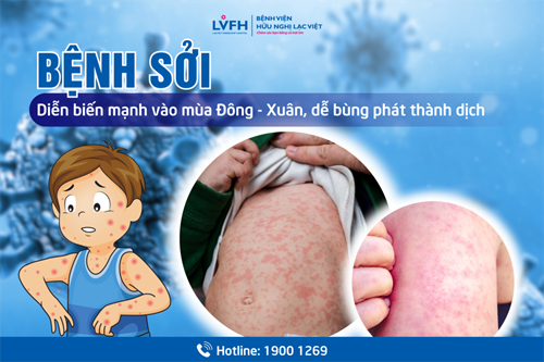 Phòng, chống bệnh Sởi cho trẻ dưới 6 tuổi
