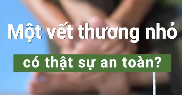 Một vết thương nhỏ có thật sự an toàn?