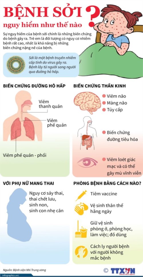 Phòng tránh bệnh Sởi