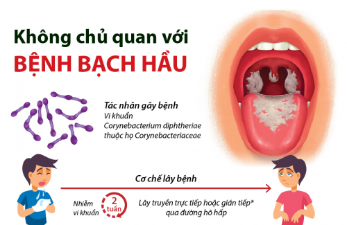Những điều cần biết về bệnh bạch hầu