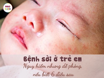 Trường Mn Sao Mai tuyên truyền: Phụ huynh cần theo dõi và đưa bé đi tiêm phòng vacxin Sởi để phòng tránh