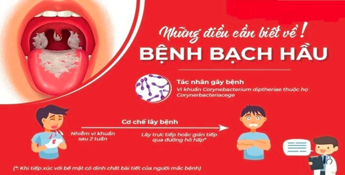 Bệnh bạch hầu: nguyên nhân, triệu chứng và cách phòng, chống