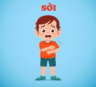 Sở Y tế kiến nghị UBND TP.HCM công bố dịch sởi