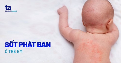 Nhận biết sốt phát ban ở trẻ nhỏ và cách xử lý