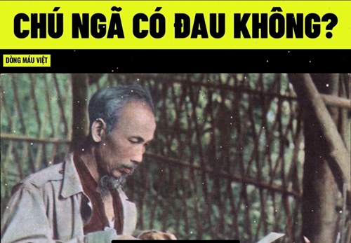 Chú ngã có đau không?
