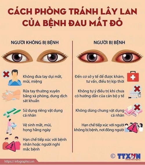 Cách phòng tránh lây lan của bệnh Đau mắt đỏ