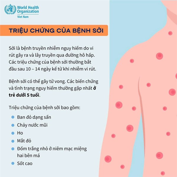 Truyền thông về phòng ngừa bệnh Sởi