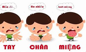 Dấu hiệu cảnh báo bệnh tay chân miệng trở nặng