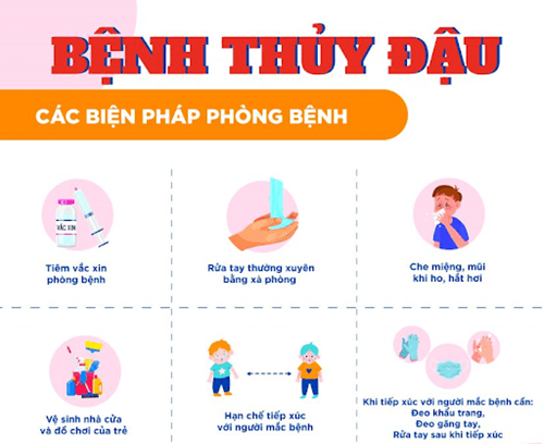 Bệnh thủy đậu và các biện pháp phòng bệnh
