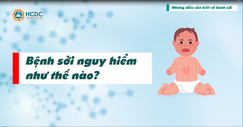 Những điều cần biết về bệnh Sởi