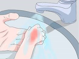 Quy trình sơ cứu, cấp cứu tổn thương bỏng nhiệt