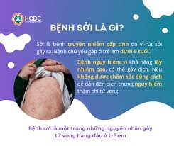 Những điều cần biết về bệnh Sởi