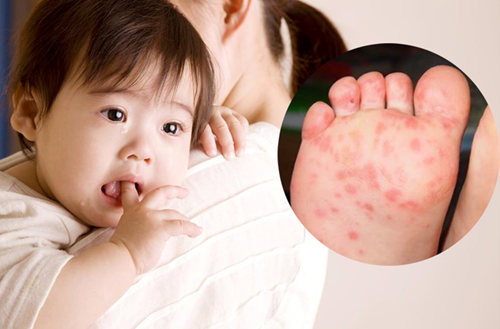 Truyền thông phòng, chống dịch bệnh tay - chân - miệng