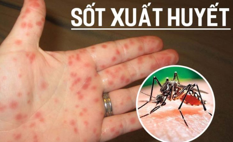 Phòng bệnh sốt xuất huyết