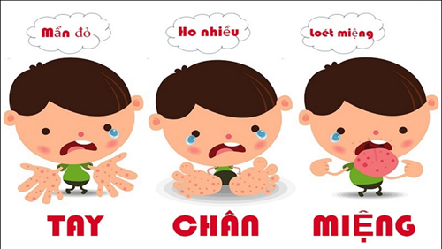Dấu hiệu nhận biết và cách phòng ngừa bệnh Tay chân miệng