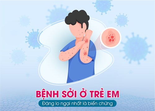 Bệnh sởi