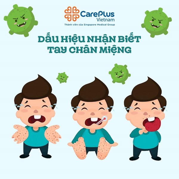 Dấu hiệu cảnh báo trẻ bị bệnh Tay - chân - miệng
