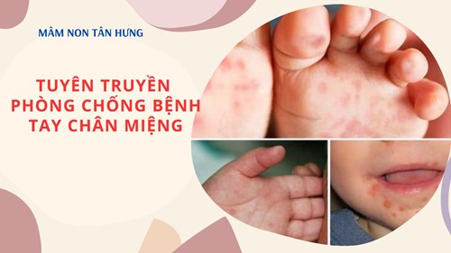 Tuyên truyền phòng chống bệnh tay chân miệng