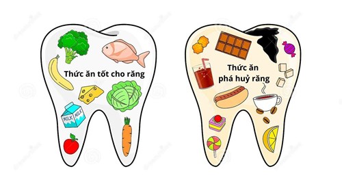 Hướng dẫn cách chăm sóc răng miệng cho trẻ