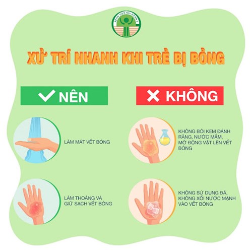Dạy trẻ cách xử trí khi bị bỏng