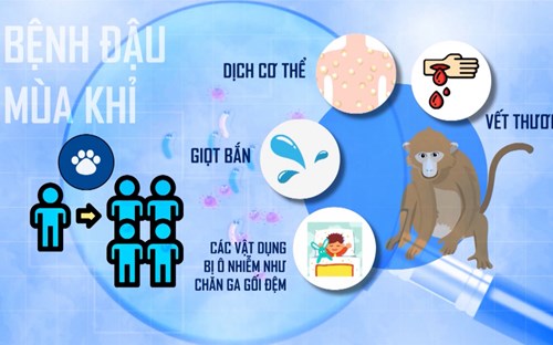 Thông tin và chủ động phòng ngừa bệnh  ĐẬU MÙA KHỈ 