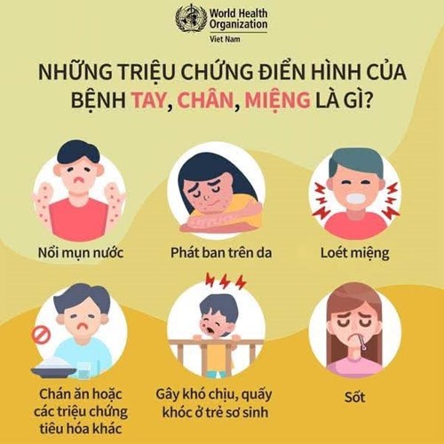 Những triệu chứng điển hình của bệnh tay chân miệng là gì?
