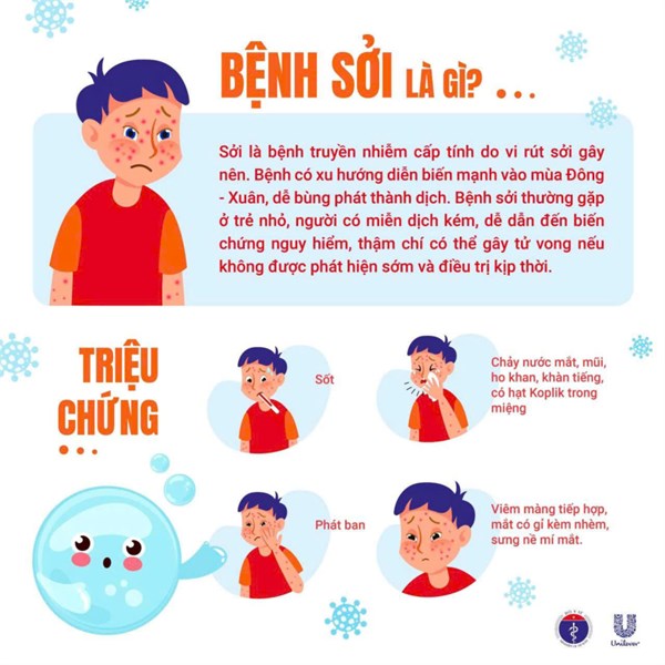 Sởi ủ bệnh như thế nào?