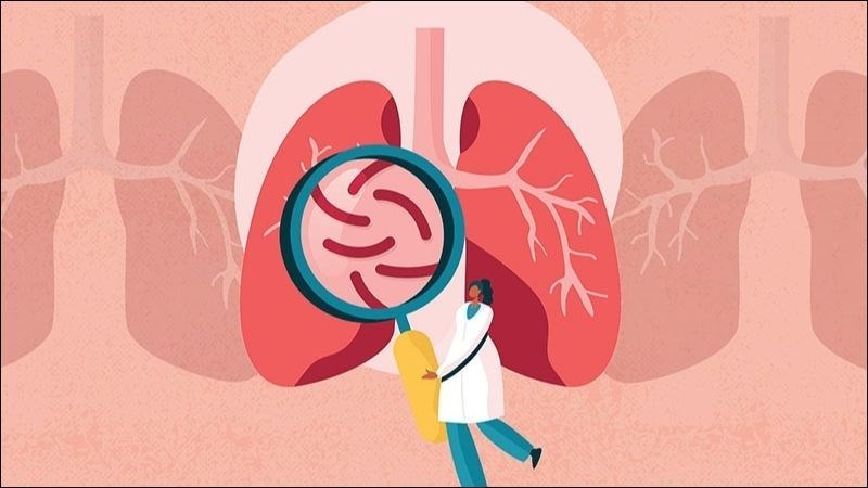 HCDC | Các triệu chứng nghi ngờ mắc bệnh lao v2