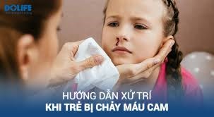 Cách xử trí trẻ bị chảy máu cam