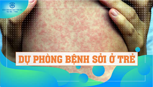 Phòng ngừa bệnh sởi thế nào để tránh mùa đại dịch?