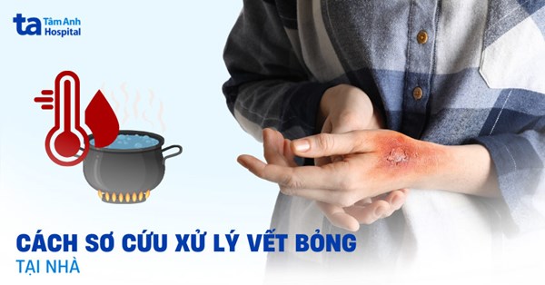 Cách sơ cứu xử lý vết bỏng
