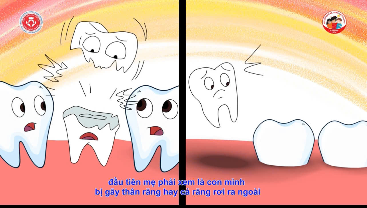 Chấn thương răng
