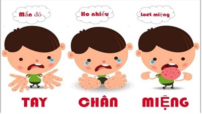 Bệnh tay-chân-miệng, nguyên nhân, triệu chứng, biến chứng và cách phòng ngừa