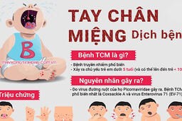 Bài tuyên truyền phòng chống bệnh tay chân miệng