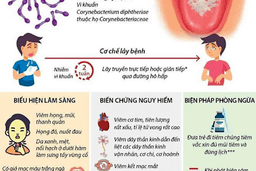 Bài tuyên truyền bệnh bạch hầu