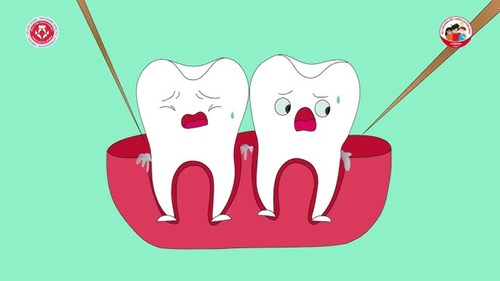Trường MN Phú Hòa Đông - Những thói quen xấu gây hại cho răng